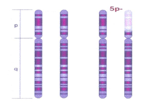 Cromosoma 5p